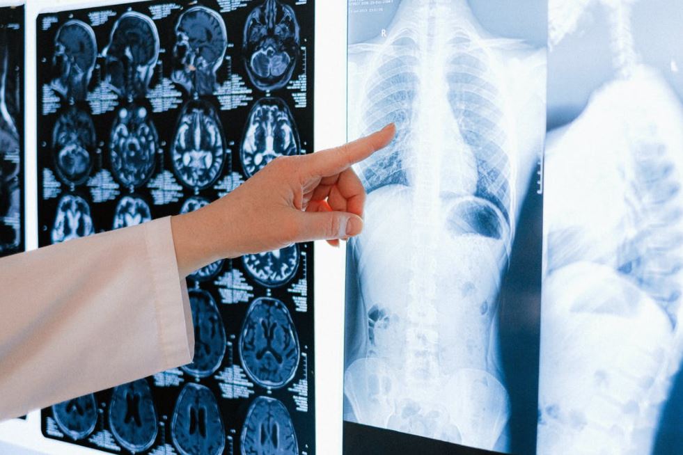 a doctor pointing to x-ray images of the body and an mri of the brain